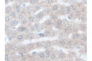 DAB staining on IHC-P; Samples: Rat Liver Tissue) (ORM1 抗体  (AA 19-186))