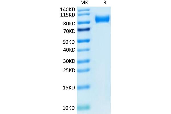 ITGB6 Protein (AA 22-706) (His tag)