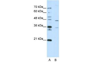 ZNF488 antibody (20R-1241) used at 0. (ZNF488 抗体  (C-Term))