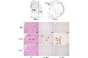 Immunohistochemistry (Paraffin-embedded Sections) (IHC (p)) image for anti-Caspase 3 (CASP3) (AA 60-100) antibody (ABIN724625)