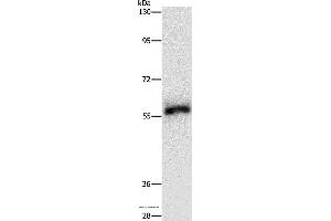 Western blot analysis of Hela cell, using HCK Polyclonal Antibody at dilution of 1:500 (HCK 抗体)