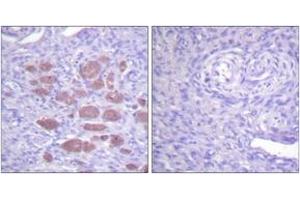 Immunohistochemistry (IHC) image for anti-Neutrophil Cytosolic Factor 4, 40kDa (NCF4) (AA 120-169) antibody (ABIN2888743) (NCF4 抗体  (AA 120-169))
