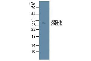 Detection of NME6 in Rat Spleen Tissue using Polyclonal Antibody to Non Metastatic Cells 6, Protein Expressed In (NME6) (Non Metastatic Cells 6, Protein Expressed In (AA 1-173) 抗体)