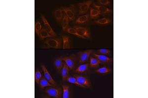 Immunofluorescence analysis of U-2 OS cells using HSP27/HSPB1Rabbit mAb (ABIN7267569) at dilution of 1:100 (40x lens). (HSP27 抗体)