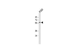 Anti-MEIS2 Antibody (Center ) at 1:2000 dilution + K562 whole cell lysate Lysates/proteins at 20 μg per lane. (MEIS2 抗体  (AA 254-280))