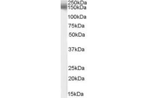 Image no. 1 for anti-Erythrocyte Membrane Protein Band 4.1 Like 3 (EPB41L3) (C-Term) antibody (ABIN374633) (EPB41L3 抗体  (C-Term))