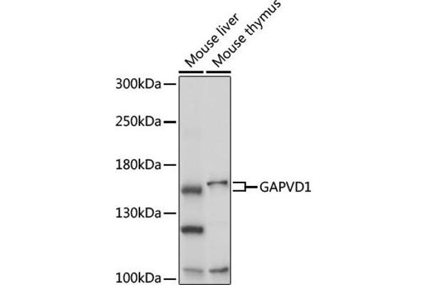 GAPVD1 抗体  (AA 1-260)