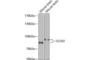 Western blot analysis of extracts of various cell lines, using CLCN2 Antibody (ABIN6133641, ABIN6138663, ABIN6138664 and ABIN6221716) at 1:1000 dilution. (CLCN2 抗体  (C-Term))