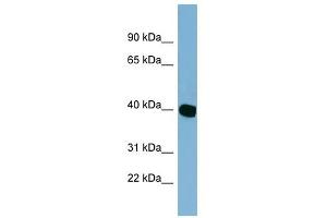 C14ORF148 antibody used at 1 ug/ml to detect target protein. (NOXRED1 抗体  (Middle Region))