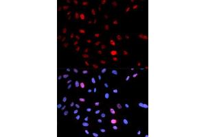 Immunofluorescence analysis of U2OS cells using Phospho-SMC1A-S957 antibody (ABIN5969934). (SMC1A 抗体  (pSer957))