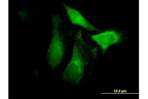 Immunofluorescence of purified MaxPab antibody to CFHR1 on HeLa cell. (CFHR1 抗体  (AA 1-330))