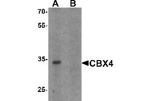 Western blot analysis of CBX4 in human brain tissue lysate with CBX4 antibody at 1 µg/mL in (A) the absence and (B) the presence of blocking peptide. (CBX4 抗体  (N-Term))