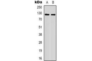 Western blot analysis of XPO1 (AcK568) expression in HepG2 UV-treated (A), mouse brain (B) whole cell lysates. (XPO1 抗体  (acLys568))