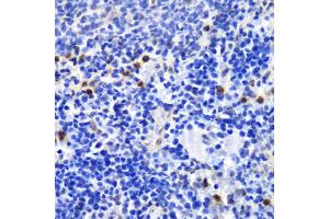 Immunohistochemistry of paraffin-embedded mouse spleen using ANXA1 antibody (ABIN5970468) at dilution of 1/100 (40x lens). (Annexin a1 抗体)