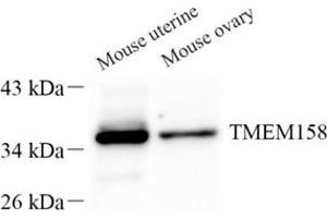 Western blot analysis of TMEM158 (ABIN7075993) at dilution of 1: 500 (TMEM158 抗体)