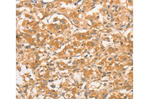 Immunohistochemistry (IHC) image for anti-Toll-Like Receptor 3 (TLR3) antibody (ABIN2422740) (TLR3 抗体)