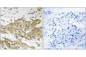 Immunohistochemistry (IHC) image for anti-Tumor Protein P53 (TP53) (pSer6) antibody (ABIN2888502) (p53 抗体  (pSer6))