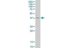 IL12B polyclonal antibody (A01), Lot # 050912JC01. (IL12B 抗体  (AA 229-328))