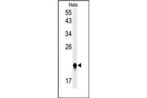 Western blot analysis of IMP3 Antibody (C-term) in Hela cell line lysates (35ug/lane). (IMP3 抗体  (C-Term))