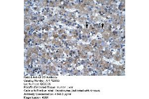 Rabbit Anti-LHX6 Antibody     Paraffin Embedded Tissue: Human Liver  Cellular Data: Hepatocytes  Antibody Concentration: 4. (LHX6 抗体  (C-Term))