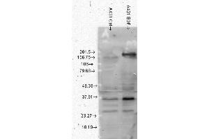 Western Blot analysis of Human A431 cell lysates showing detection of Phosphotyrosine protein using Mouse Anti-Phosphotyrosine Monoclonal Antibody, Clone G104 . (Phosphotyrosine 抗体  (APC))