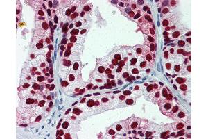 Anti-FOXA1 antibody IHC of human prostate. (FOXA1 抗体  (AA 367-473))