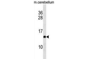 Western Blotting (WB) image for anti-Prefoldin Subunit 2 (PFDN2) antibody (ABIN3001026) (PFDN2 抗体)