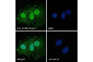 Immunofluorescence (IF) image for anti-Intraflagellar Transport 88 Homolog (IFT88) (C-Term) antibody (ABIN185555)