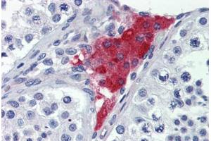 Human Testis: Formalin-Fixed, Paraffin-Embedded (FFPE) (Junctophilin 4 抗体  (Internal Region))