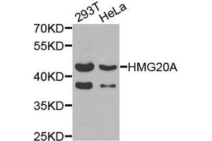 Western blot analysis of extracts of 293T and HeLa cells, using HMG20A antibody. (HMG20A 抗体)