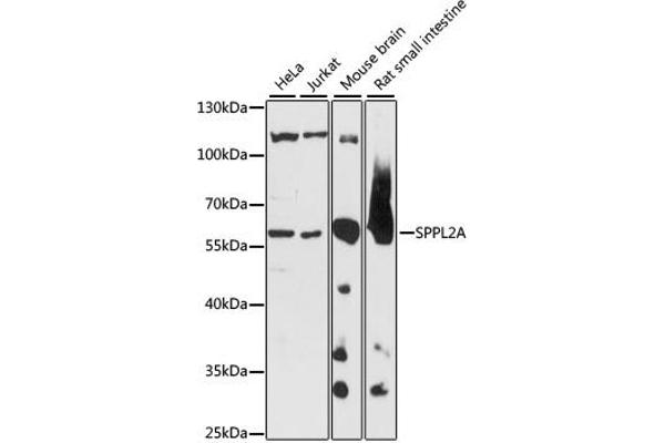 SPPL2A 抗体  (AA 421-520)