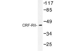Image no. 1 for anti-Corticotropin Releasing Hormone Receptor 2 (CRHR2) antibody (ABIN317648) (CRHR2 抗体)