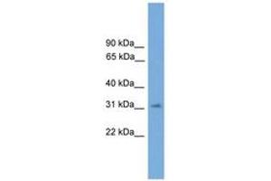 Image no. 1 for anti-Sprouty Homolog 3 (SPRY3) (AA 71-120) antibody (ABIN6744884) (SPRY3 抗体  (AA 71-120))