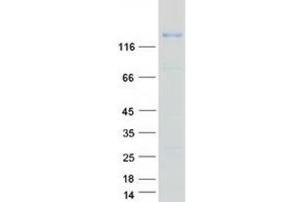 SEZ6L Protein (Transcript Variant 2) (Myc-DYKDDDDK Tag)