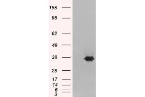 Western Blotting (WB) image for anti-Mortality Factor 4 Like 2 (MORF4L2) antibody (ABIN5871243) (MORF4L2 抗体)