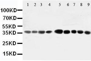 Western Blotting (WB) image for anti-Aminoacyl tRNA Synthetase Complex-Interacting Multifunctional Protein 2 (AIMP2) (AA 298-320), (Middle Region) antibody (ABIN3044411) (AIMP2 抗体  (Middle Region))