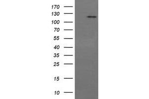 Image no. 6 for anti-PTK2 Protein tyrosine Kinase 2 (PTK2) antibody (ABIN1498193) (FAK 抗体)