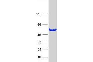 Validation with Western Blot (PIP4K2A Protein (Myc-DYKDDDDK Tag))