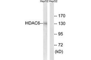Western blot analysis of extracts from HepG2 cells, using HDAC6 (Ab-22) Antibody. (HDAC6 抗体  (AA 7-56))