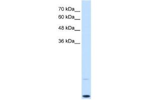 WB Suggested Anti-MYC Antibody Titration:  0. (c-MYC 抗体  (C-Term))