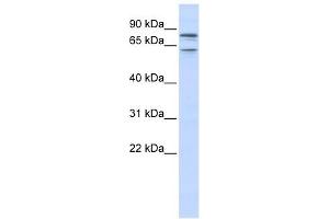KCNQ1 antibody used at 1 ug/ml to detect target protein. (KCNQ1 抗体  (N-Term))