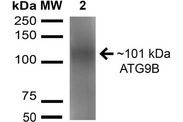 ATG9B 抗体  (AA 110-121)
