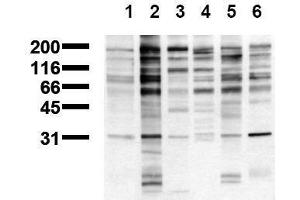 Western Blotting (WB) image for anti-Phosphotyrosine (phosphorylated) antibody (ABIN126878) (Phosphotyrosine 抗体  (phosphorylated))