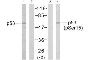 Western blot analysis of the extracts from HeLa cells untreated or treated with hydroxyurea using p53 (Ab-15) antibody (E021085, Line1 and 2) and p53 (phospho-Ser15) antibody (E011094, Line3 and 4). (p53 抗体)