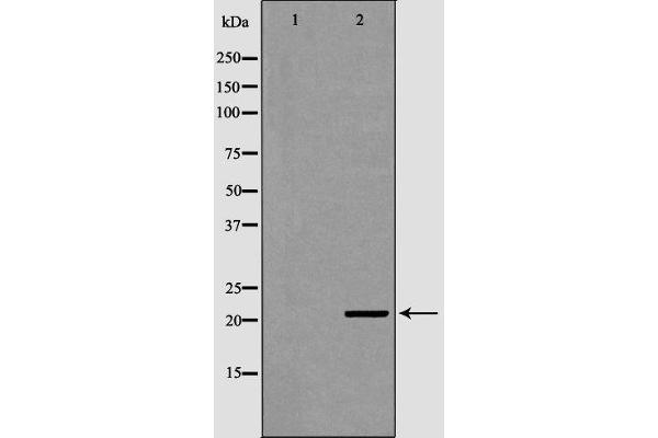 ITPA 抗体  (Internal Region)