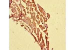 Immunohistochemistry of paraffin-embedded human heart tissue using ABIN7171680 at dilution of 1:100 (TECPR1 抗体  (AA 199-487))