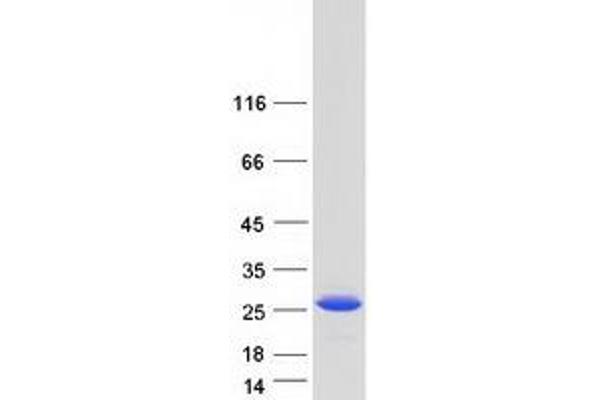 RCL Protein (Transcript Variant 1) (Myc-DYKDDDDK Tag)