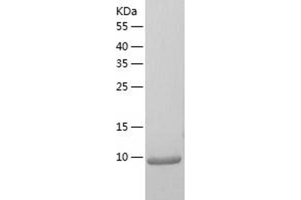 CCL3 Protein (AA 23-92) (His tag)