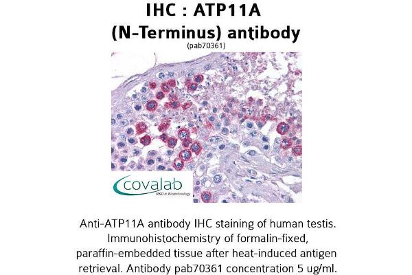 ATP11A 抗体  (N-Term)