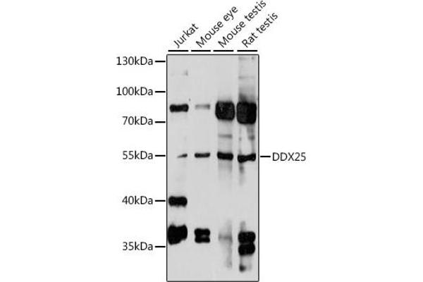 DDX25 抗体  (AA 284-483)